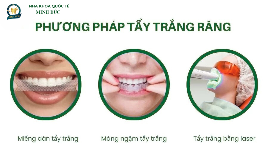 Phương pháp tẩy trắng răng phổ biến hiện nay