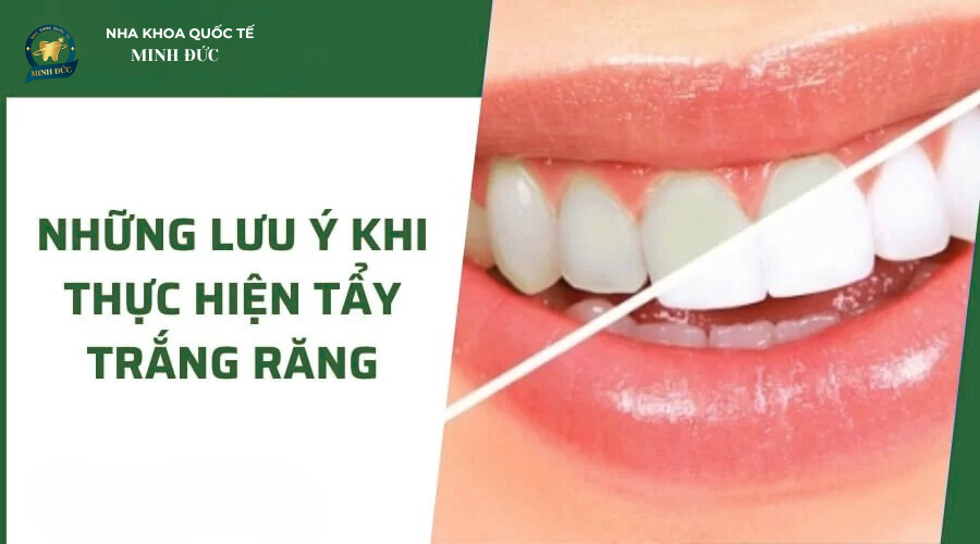 Những lưu ý sau khi tẩy trắng răng